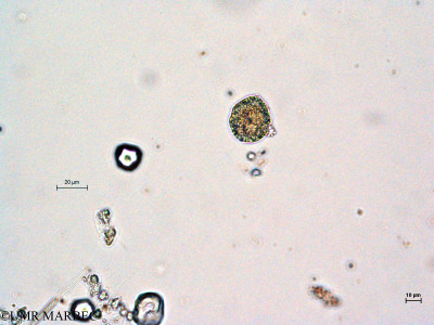phyto/Thau_Lagoon/THAU_station1/GELAMED 2010/Pentapharsodinium dalei (old Protoperidinium americanum -2)(copy)_thumb.jpg